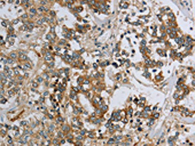 HSD17B14 Antibody (PACO16493)
