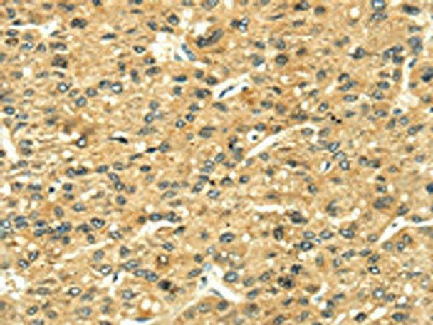 LEP Antibody (PACO16613)