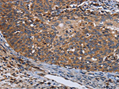LRRC15 Antibody (PACO16631)