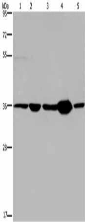 LZTFL1 Antibody (PACO16640)