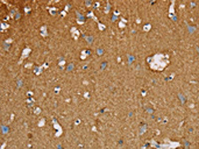 MBNL3 Antibody (PACO16658)