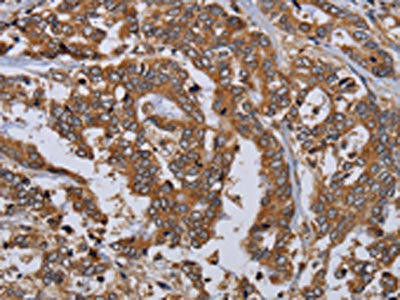 MFAP3L Antibody (PACO16675)