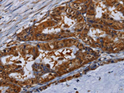 MFAP3L Antibody (PACO16676)