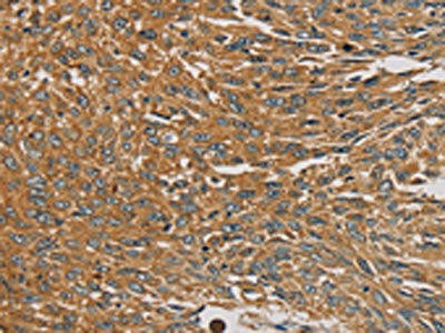 PARP11 Antibody (PACO16842)
