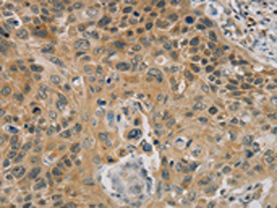 PARP11 Antibody (PACO16843)