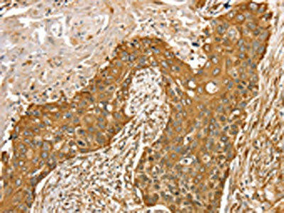 RASSF9 Antibody (PACO16948)