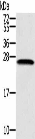 SSX1 Antibody (PACO17152)