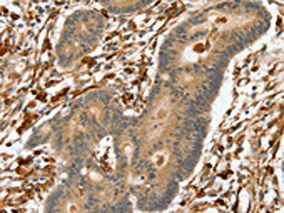 SSX2IP Antibody (PACO17154)