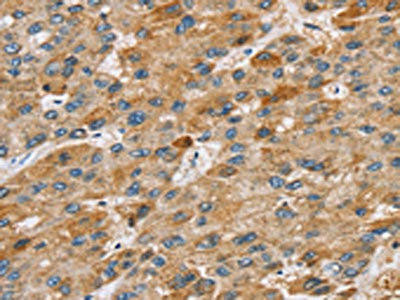 STARD8 Antibody (PACO17162)