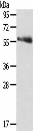 SRPK3 Antibody (PACO17170)