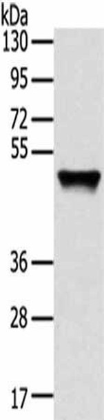 TRIM14 Antibody (PACO17254)