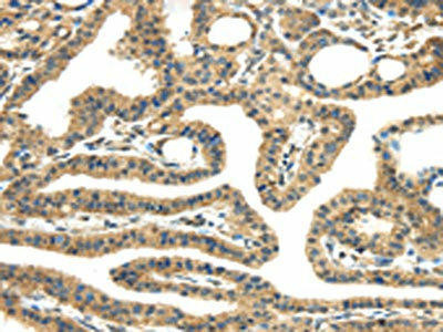 TMPRSS11E Antibody (PACO17281)
