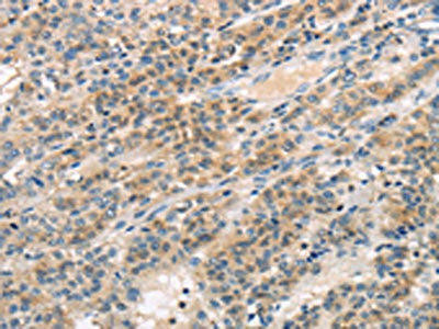 TTC23 Antibody (PACO17332)