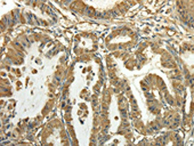 TUBA1C Antibody (PACO17334)