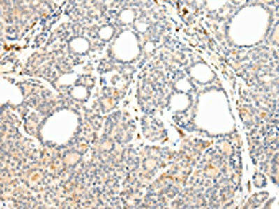 VPS41 Antibody (PACO17435)
