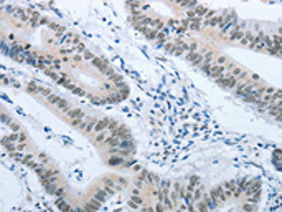 ACIN1 Antibody (PACO17486)