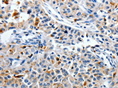 CDK3 Antibody (PACO17680)