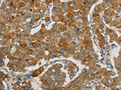 FOXF2 Antibody (PACO17874)