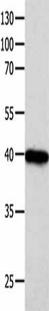FOXL1 Antibody (PACO17898)