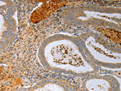 FOXN1 Antibody (PACO17902)