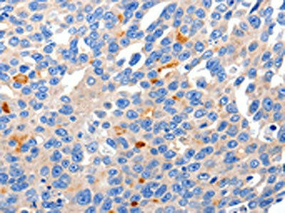 KCNH8 Antibody (PACO18046)