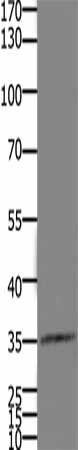 HOXD11 Antibody (PACO18080)