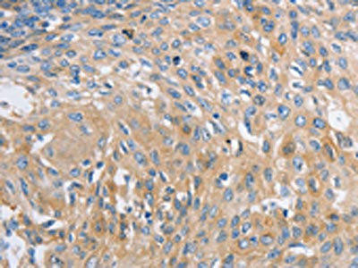 NBEA Antibody (PACO18286)