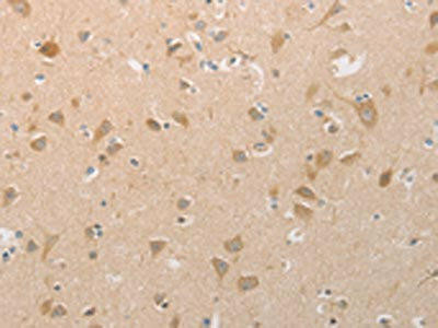 PGA3/PGA4/PGA5 Antibody (PACO18355)