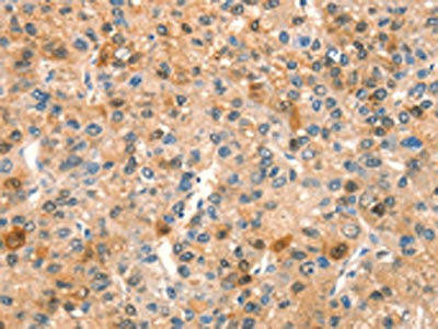SPRN Antibody (PACO18390)