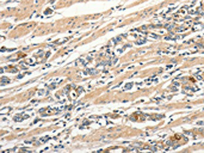 SLC41A2 Antibody (PACO18409)