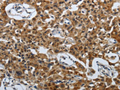 SPAG4 Antibody (PACO18426)