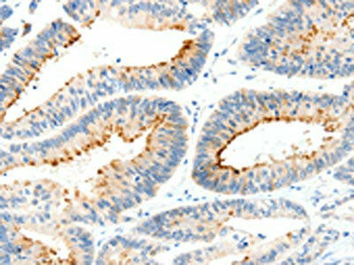 MAP4K1 Antibody (PACO18444)
