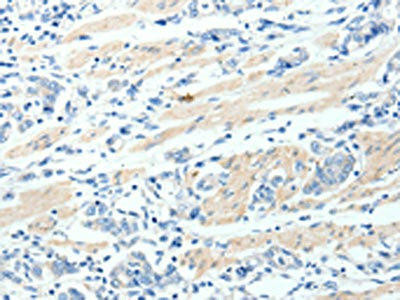 MAP4K1 Antibody (PACO18445)