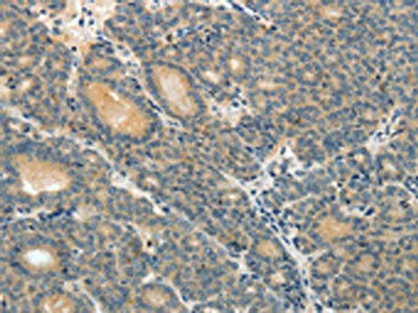 ABCC12 Antibody (PACO18497)