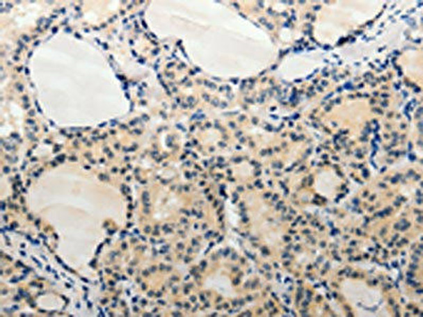 ADAMTS6 Antibody (PACO18516)
