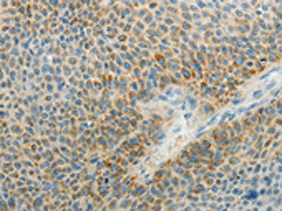 AGAP1 Antibody (PACO18527)