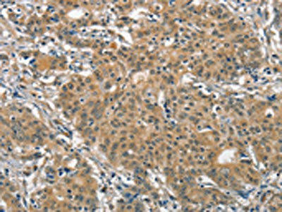 ANAPC4 Antibody (PACO18571)