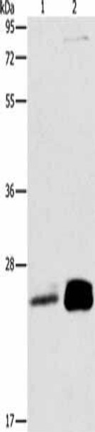 MOB1B Antibody (PACO18610)