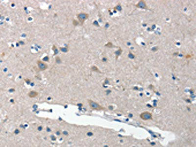 ANP32C Antibody (PACO18652)