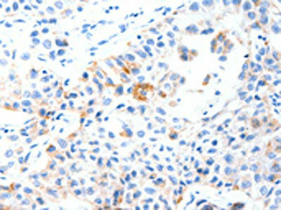 MUC3A Antibody (PACO18715)