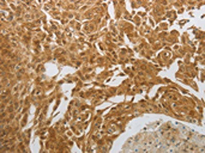 NIT2 Antibody (PACO18756)