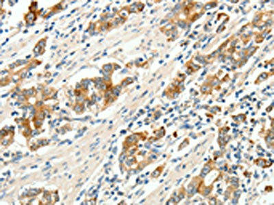 SCN9A Antibody (PACO18874)