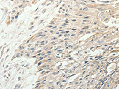 SLC9A7 Antibody (PACO18908)