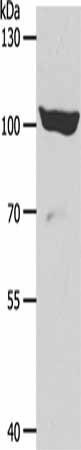 ADAMTS15 Antibody (PACO19059)