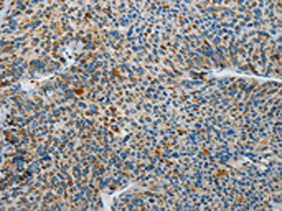 NEK5 Antibody (PACO19209)