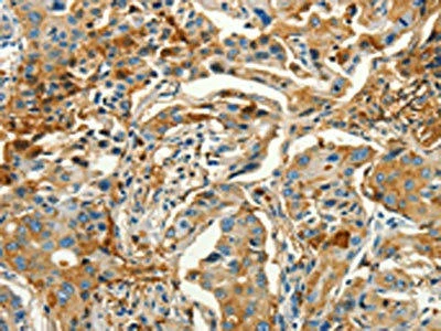 CALCA Antibody (PACO19218)
