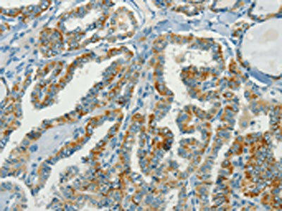 NPAP1 Antibody (PACO19223)