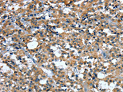 GINS1 Antibody (PACO19241)