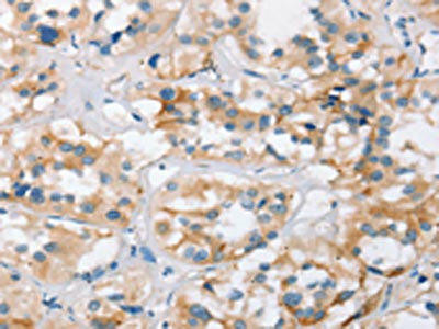 BCAS4 Antibody (PACO19345)