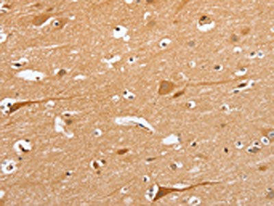 BLNK Antibody (PACO19351)